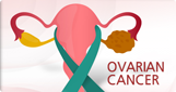 난소암